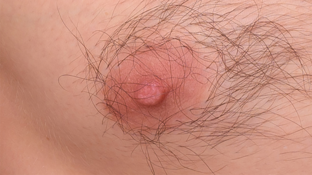 Illustration for article titled An Enemy In Hiding: Amongst These Innocent
MaleĀ NipplesĀ Lurks A Wicked FemaleĀ Nipple!